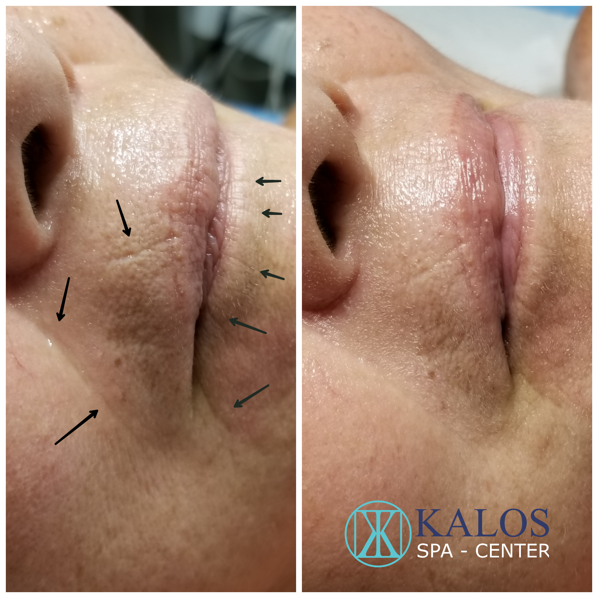 Image of a facial in Miami