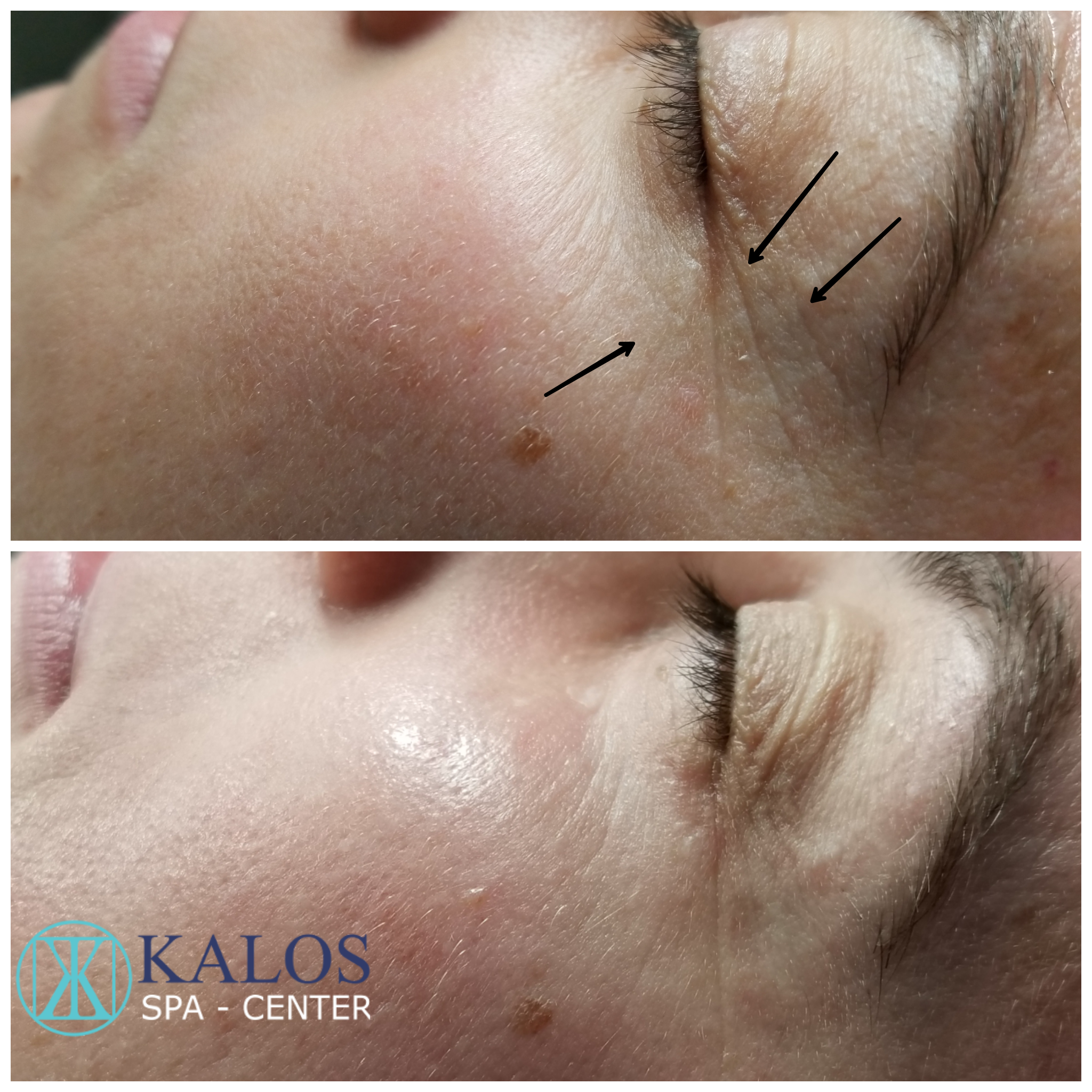 Image of a facial in Miami