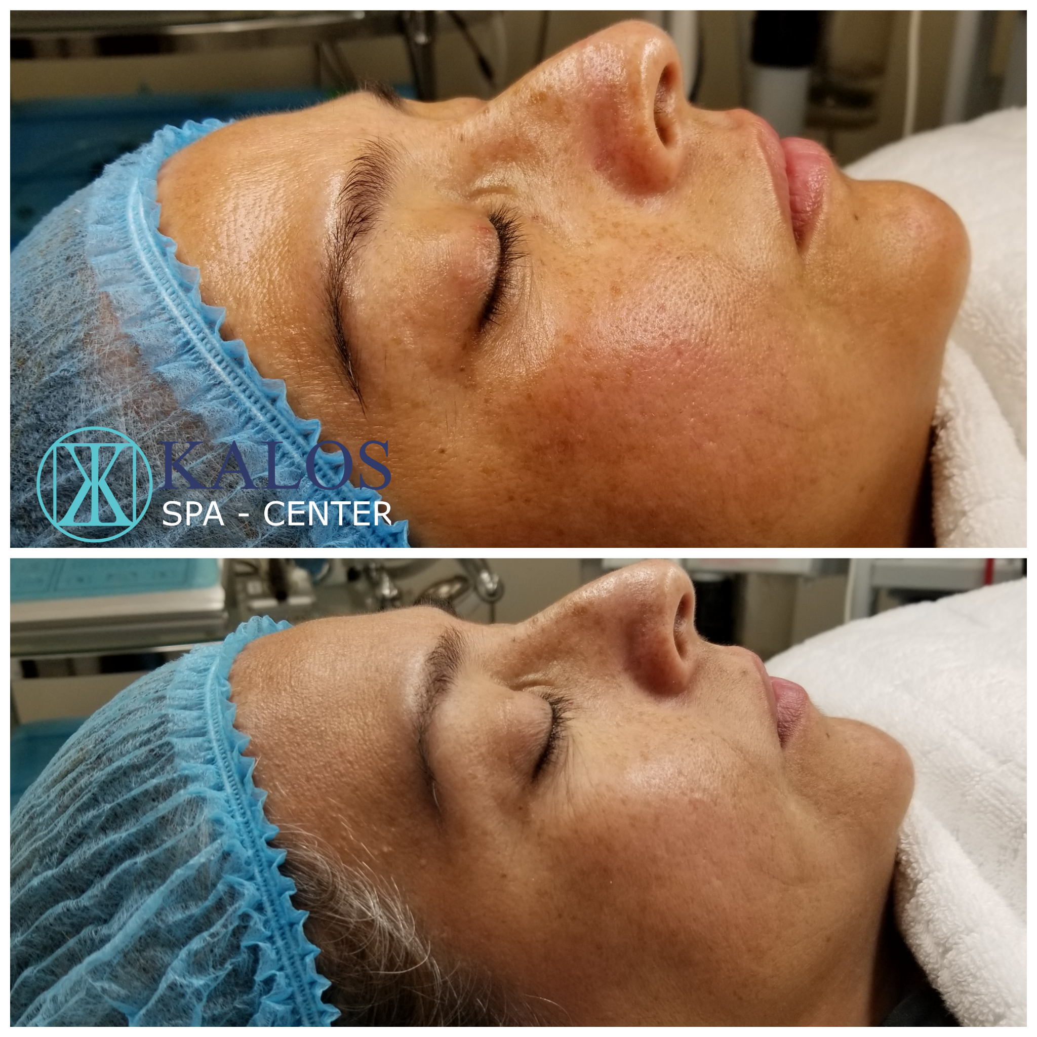 Image of a facial in Miami