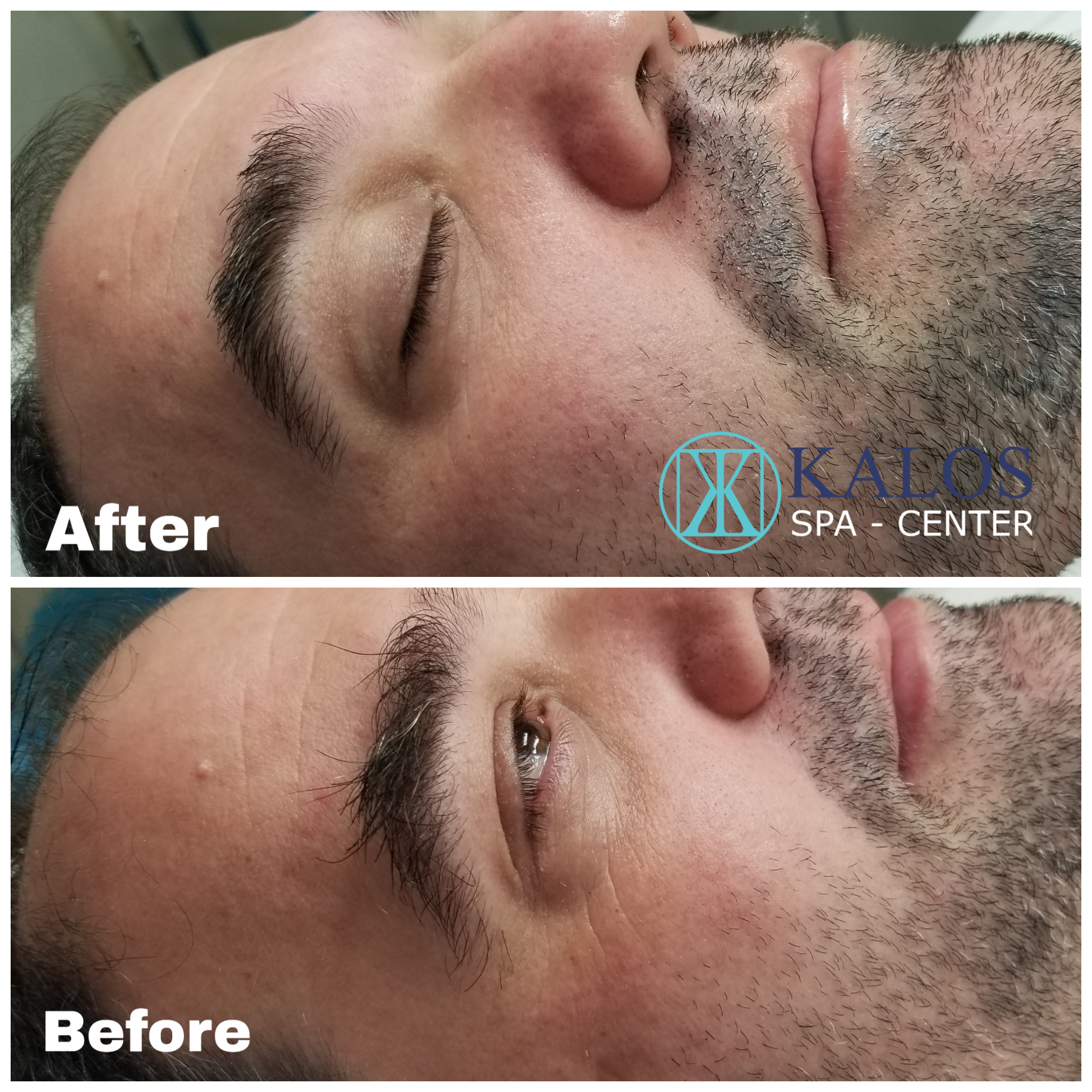 Image of a facial in Miami