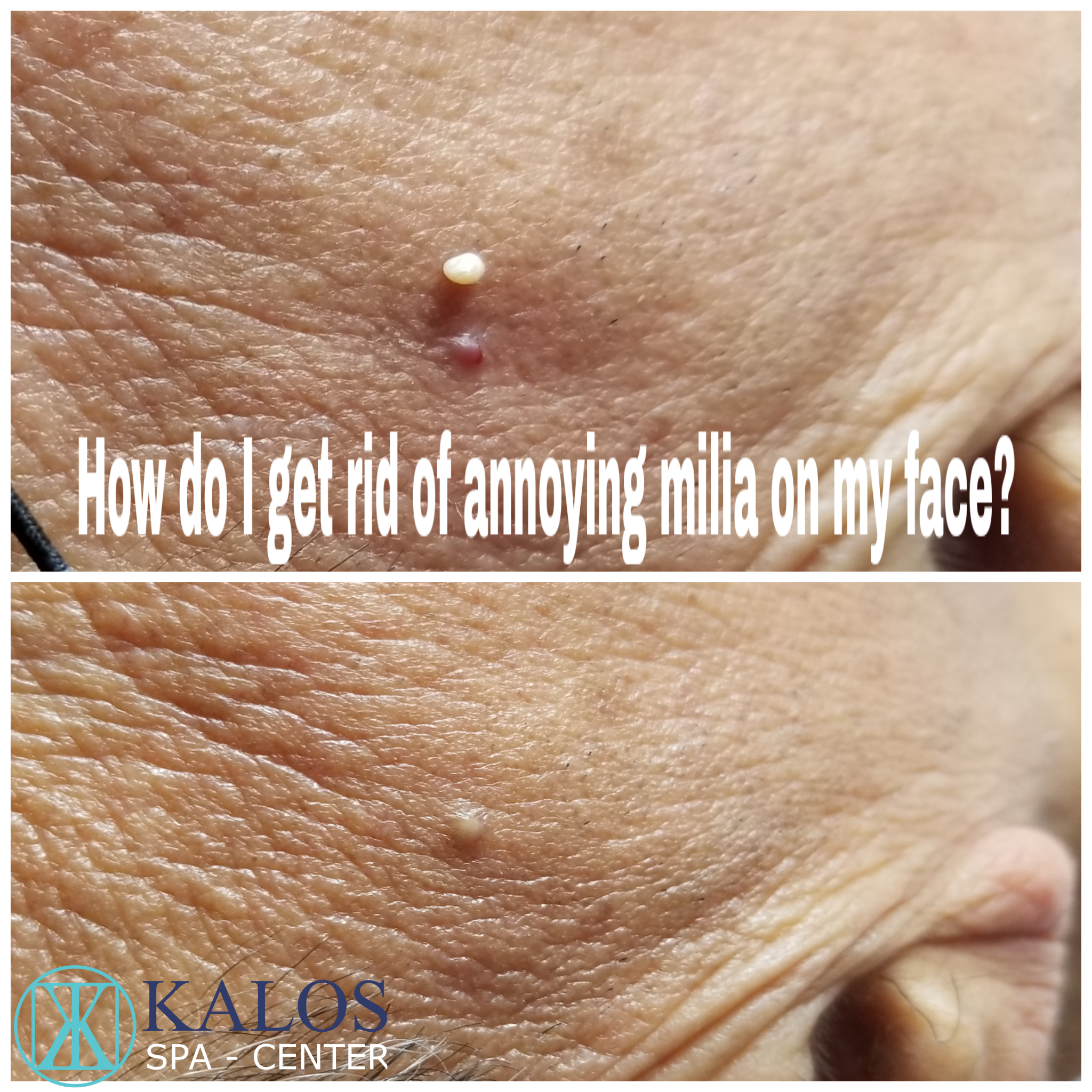 Image of a facial in Miami